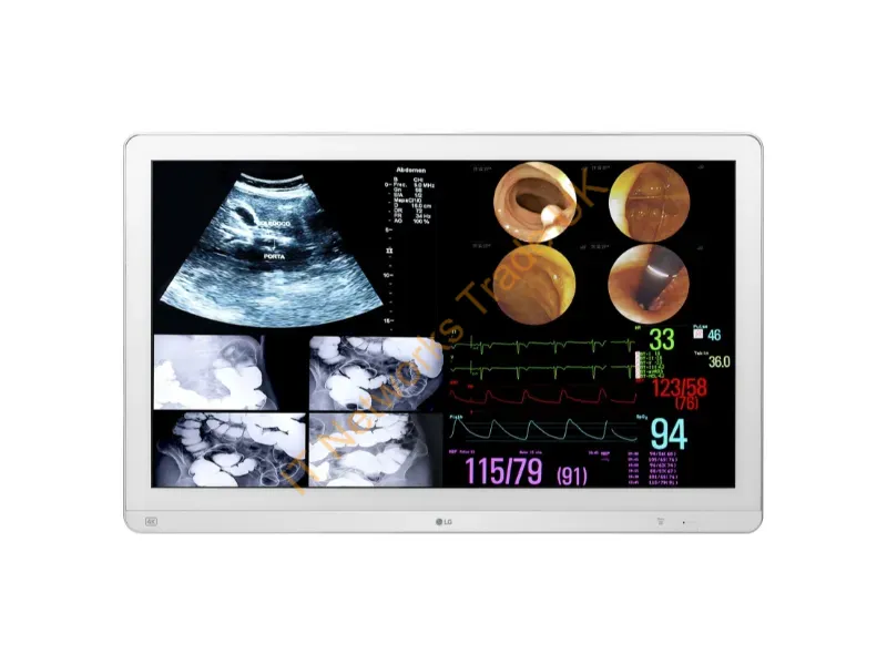 32HL714S-W - Lg 32Hl714S-W Computer Monitor 31.5" 3840 X 2160 Pixels 4K Ultra Hd White
