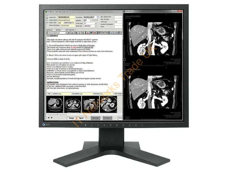MX194-BK - Eizo Radiforce Mx194 Led Display 19" 1280 X 1024 Pixels Lcd Black